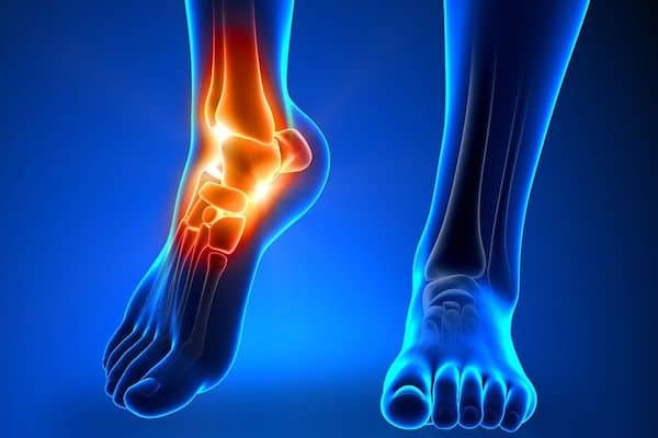 Fit Feet Podiatrists Larne Northern Ireland Biomechanical Evaluation 600x